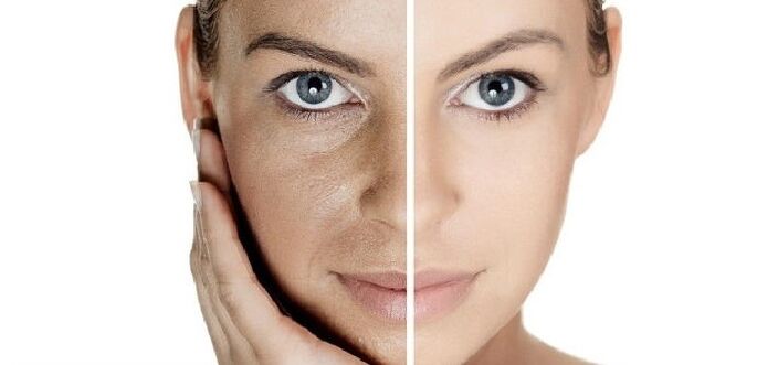 antes y después del rejuvenecimiento de la piel facial