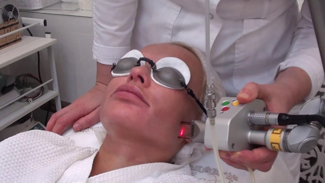 Tratamiento con rayo láser de áreas problemáticas de la piel de la cara. 