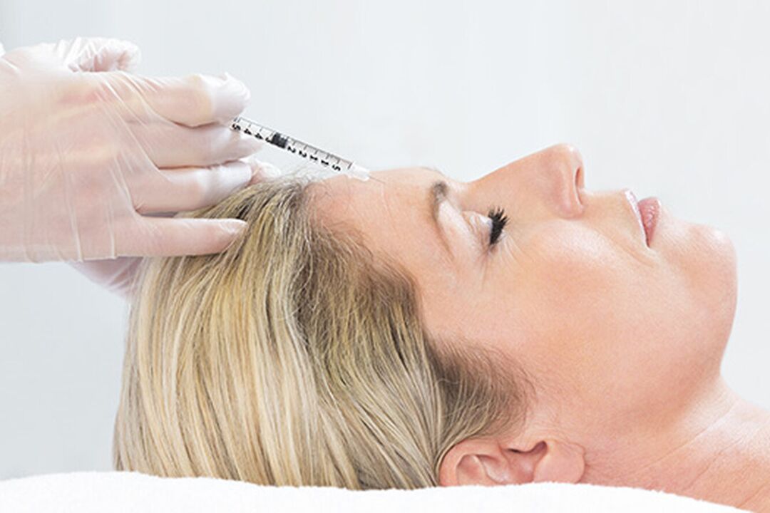 Plasmolifting es un método de inyección de rejuvenecimiento de la piel facial